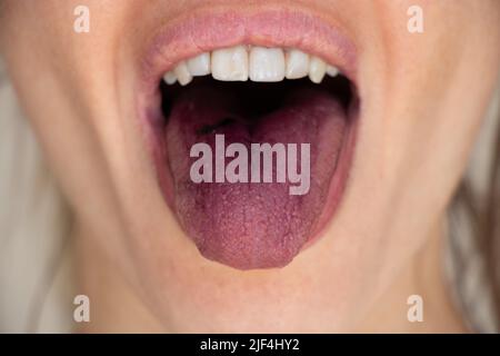 Rote Zunge nach Maulbeere, offener Mund und Zunge eines Mädchens aus der Nähe Stockfoto
