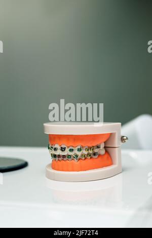 Ein Modell des Kiefers mit Zahnspangen liegt auf dem Tisch beim Kieferorthopäden Stockfoto