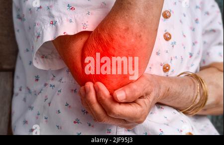 Schmerzen im Ellenbogengelenk der älteren südostasiatischen Frau. Konzept von Ellenbogenschmerzen, rheumatoider Arthritis und Armproblemen. Stockfoto