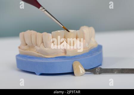 Nahaufnahme von Malarbeiten an künstlichen Gebiss mit einem Pinsel in einem Zahnlabor Stockfoto