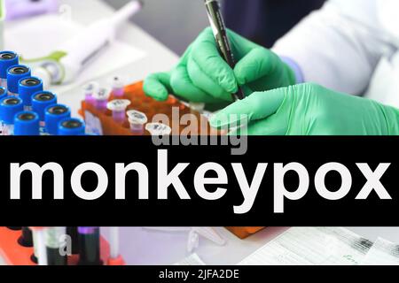 Monkeypox-Reagenzgläser analysieren im Labor Stockfoto