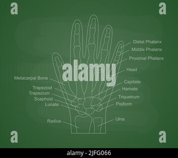 Anatomie der menschlichen Handknochen auf einem grünen Schulbrett. Menschliches Handdiagramm mit Knochenbeschreibung. Pädagogische Inhalte für die medizinische Universität Stock Vektor
