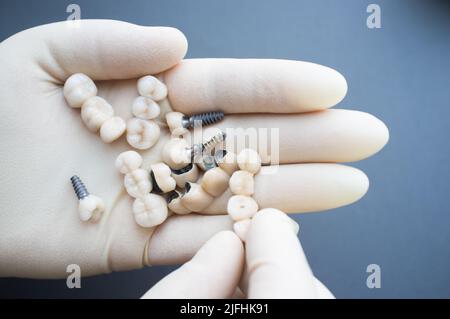 Vielzahl von Prothesen in zahnärztlichen Händen Stockfoto