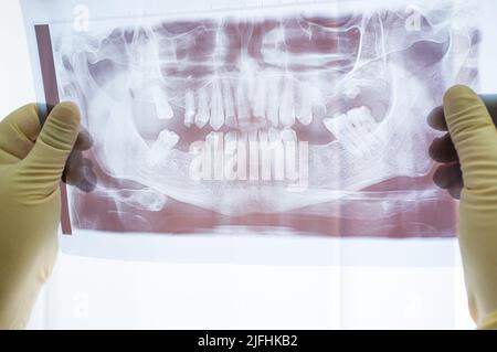 Vorderansicht des dentalen Röntgenscans der Kiefer Stockfoto