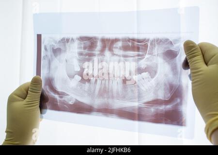 Dentale Panorama-Röntgenaufnahme des Kiefers aus nächster Nähe Stockfoto