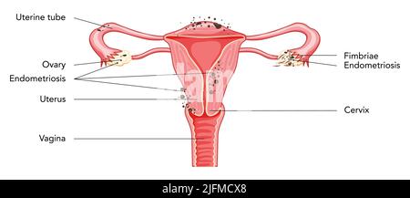 Weibliches Fortpflanzungssystem Uterusdiagramm mit Inschriften in lateinischem Text. Vorderansicht im Schnitt. Darstellung der Lage der inneren Organe der menschlichen Anatomie, Gebärmutterhals, Eierstöcken, Eileiter im flachen Stil isoliert Stock Vektor