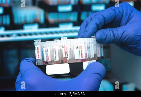 Monkeypox-Virus-Teströhrchen in Händen mit blauen Handschuhen Stockfoto