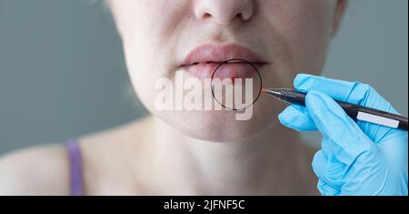 Junge Frau besucht männlichen Arzt Dermatologe Stockfoto