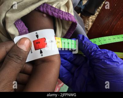 Baidoa, Somalia. 29.. Juni 2022. In einer Klinik in Baidoa misst ein Arzt den Armumfang eines somalischen Babys. Die rote Markierung bedeutet, dass das Kind stark unterernährt ist und dringend spezielle Nahrung benötigt. Nach vier gescheiterten Regenzeiten am Horn von Afrika sind vor allem junge Kinder vom Hungertod bedroht. (To dpa 'Wettlauf gegen die Zeit, um das Leben hungernder Kinder zu retten') Quelle: Eva-Maria Krafczyk/dpa/Alamy Live News Stockfoto