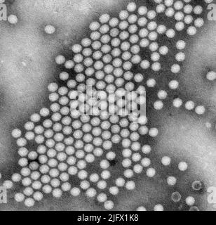 Dieses transmissionselektronenmikroskopische (TEM) Negativbild zeigt einige der ultrastrukturellen Merkmale, die durch eine Gruppe von Ikosaedral-förmigen Polio-Virus-Partikeln gezeigt werden. Eine optimierte und verbesserte Version eines Bildes, das von den US Centers for Disease Control and Prevention / Credit CDC / J.J. Esposito; F.A.Murphy produziert wurde Stockfoto