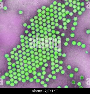 Dieses transmissionselektronenmikroskopische (TEM) Negativbild zeigt einige der ultrastrukturellen Merkmale, die durch eine Gruppe von Ikosaedral-förmigen Polio-Virus-Partikeln gezeigt werden. Digital koloriertes /Falschfarbenbild. Eine optimierte und verbesserte Version eines Bildes, das von den US Centers for Disease Control and Prevention / Credit CDC / J.J. Esposito; F.A.Murphy produziert wurde Stockfoto