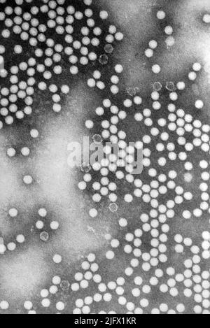 Dieses transmissionselektronenmikroskopische (TEM) Bild zeigt zahlreiche runde Virionen des Typs Poliovirus vom Typ 1, die einen Durchmesser von 20-30nm gemessen und eine Ikosaedralsymmetrie aufweisen. Eine optimierte und verbesserte Version eines Bildes, das von den US Centers for Disease Control and Prevention / Credit CDC / Dr.Joseph J. Esposito; F.A.Murphy produziert wurde Stockfoto