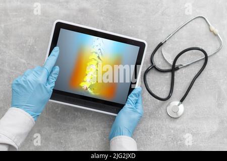 Arzt beobachtet eine Röntgenaufnahme von Hüfte und Wirbelsäule auf Rückenschmerzen auf einem digitalen Tablet. Stockfoto