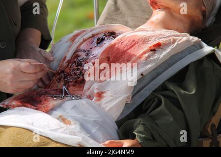 Eine Darstellung einer furchtbaren Verletzung an einem Mannequin-Modell. Stockfoto