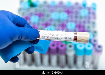 Positive Blutinfektionsprobe im Reagenzglas für CENTAURUS BA 2,75 omicron covid19 Coronavirus im Labor. Wissenschaftler hält an, um zu prüfen und zu analysieren Stockfoto