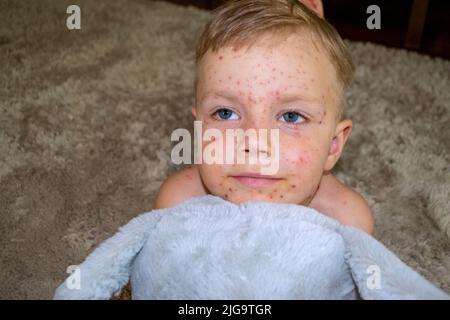 Natürliche Impfung. Ansteckende Krankheit. Stockfoto