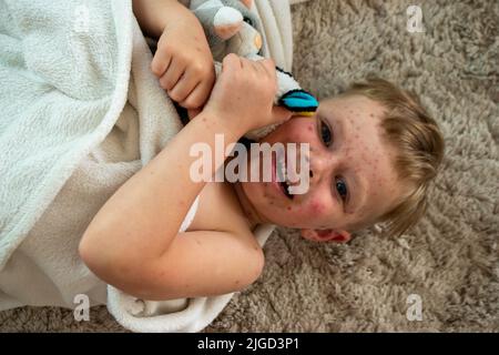 Natürliche Impfung. Ansteckende Krankheit. Stockfoto