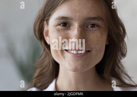 Porträt einer Sommersprossen-Frau mit natürlicher Schönheit und Blick auf die Kamera Stockfoto