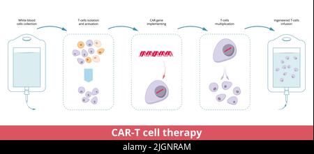 CAR-T-Zelltherapie. Chimäre Antigen-Rezeptor-T-Zellen sind T-Zellen, die genetisch für die Immuntherapie entwickelt wurden Stock Vektor