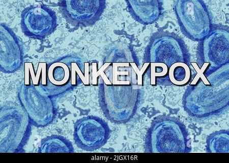 Monkeypox-Virus unter dem Mikroskop, blauer Farbton, mit Textbanner Stockfoto