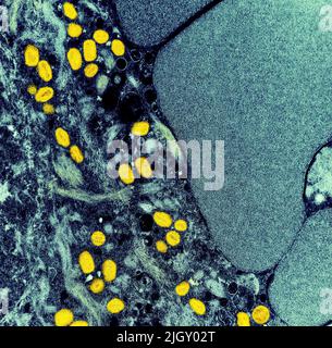 Monkeypox. Kolorierte Transmissionselektronenmikroskopie reifer extrazellulärer Nipah-Viruspartikel (rot) nahe der Peripherie einer infizierten VERO-Zelle (blau und grün). Aufnahme in der NIAID Integrated Research Facility in Fort Detrick, Maryland. Credit NIAID Monkeypox ist eine infektiöse Viruserkrankung, die bei Menschen und einigen anderen Tieren auftreten kann.Symptome sind Fieber, geschwollene Lymphknoten und ein Ausschlag, der Blasen bildet und dann Krusten über. Die Zeit von der Exposition bis zum Einsetzen der Symptome reicht von 5 bis 21 Tage. Die Dauer der Symptome beträgt in der Regel 2 bis 4 Wochen. Stockfoto