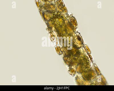 Filamentöse Algen unter mikroskopischer Ansicht Stockfoto