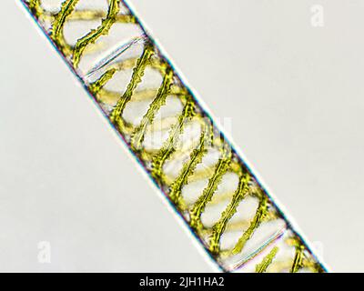 Spirogyra sp. Algen unter mikroskopischer Sicht, Chlorophyta Stockfoto