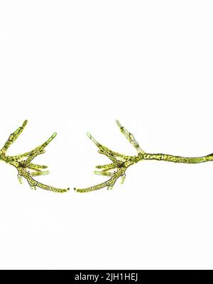 Spirogyra-Algen unter mikroskopischer Ansicht x40, Chlorophyta ...