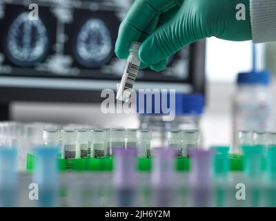 Alzheimer- und Demenzforschung, konzeptuelles Bild Stockfoto