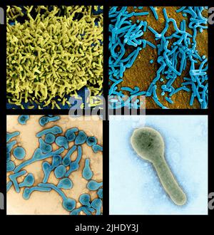 Ghana hat die ersten beiden Fälle des tödlichen Marburg-Virus bestätigt, einer hochinfektiösen Krankheit in derselben Familie wie das Ebola-Virus. Beide Patienten starben im Krankenhaus in der Ashanti-Region im Süden des Landes. 18. Juli 2022 Eine einzigartige Zusammenstellung aus 4 Rasterelektronenmikroskopischen Aufnahmen von Marburg-Viruspartikeln, die aus infizierten VERO E6-Zellen gewonnen wurden. Hochauflösende (ca. 70MB cm bei 300dpi; 40 cm) Dateien, die nach Wunsch zu Einzelbildern bearbeitet werden können. Eine optimierte und verbesserte, einzigartige Composite-Version von 4 Rasterelektronenmikrographen-Bildern, Quelle: NIAID / Alamy Live News Stockfoto