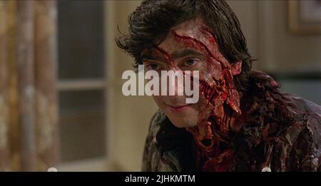 GRIFFIN DUNNE, AMERICAN WEREWOLF IN LONDON, 1981 Stockfoto