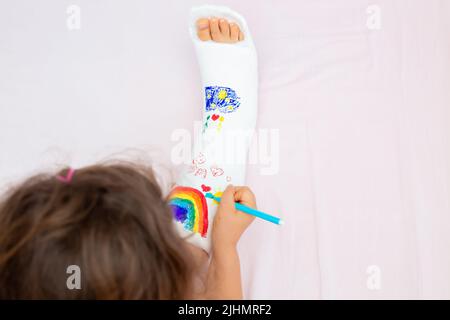 Ein unbekanntes kleines Mädchen mit einem gebrochenen Bein zu Hause auf dem Bett zieht mit Filzstiften auf einem orthopädischen Cast. Wie man Spaß mit einem gebrochenen Bein hat Stockfoto