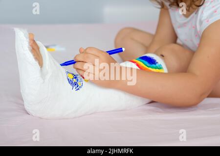 Ein unbekanntes kleines Mädchen mit einem gebrochenen Bein zu Hause auf dem Bett zieht mit Filzstiften auf einem orthopädischen Cast. Wie man Spaß mit einem gebrochenen Bein hat Stockfoto