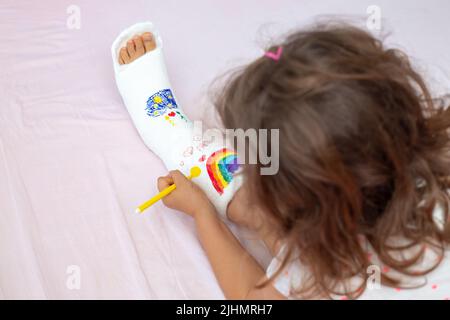 Ein unbekanntes kleines Mädchen mit einem gebrochenen Bein zu Hause auf dem Bett zieht mit Filzstiften auf einem orthopädischen Cast. Wie man Spaß mit einem gebrochenen Bein hat Stockfoto