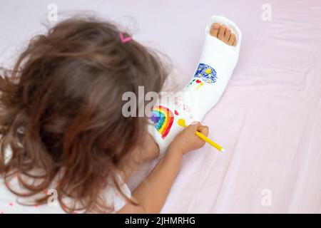 Ein unbekanntes kleines Mädchen mit einem gebrochenen Bein zu Hause auf dem Bett zieht mit Filzstiften auf einem orthopädischen Cast. Wie man Spaß mit einem gebrochenen Bein hat Stockfoto