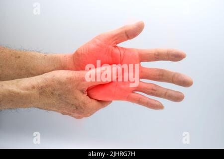 Schmerzhafter Palmaraspekt des asiatischen alten Mannes. Konzept des Kompartiment-Syndroms, Zellulitis und Schmerzen der Handmuskulatur. Stockfoto