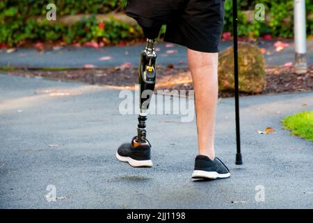 Mann, der mit einem prothetischen Bein läuft Stockfoto