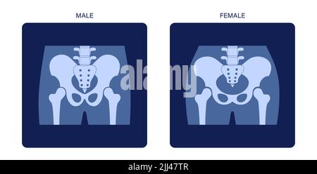 Anatomie des Beckens, Abbildung. Stockfoto