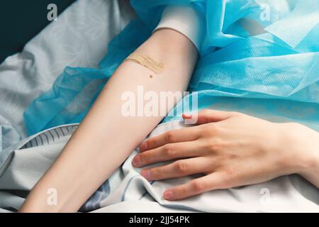 Nahaufnahme der Hand einer Frau mit einem Pfand auf ihrem Arm. Patient liegt nach der Operation auf einem Krankenhausbett. Stockfoto