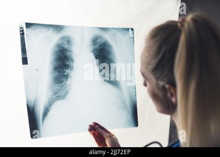 Langhaarige Lungenfachfrau im Krankenhaus untersucht Röntgenaufnahmen der Lunge, um die Brustschmerzen ihrer Patientin zu verstehen. Hochwertige Fotos Stockfoto