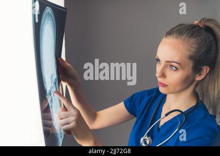 Hübsche kaukasische Ärztin in blauer Uniform und Stethoskop mit Fokus auf einem Schädelröntgenbild. Patienten- und Verletzungskonzept. Hochwertige Fotos Stockfoto