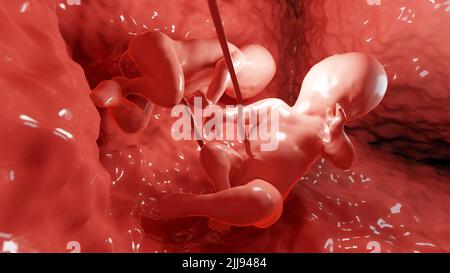 Zwillinge im Mutterleib, Monozygotische Zwillinge in der Gebärmutter mit einer einzigen Plazenta, menschliche Zwillingsfötus, pränatal wachsendes Baby, Schwangerschaftsgesundheit und fetales, Stockfoto