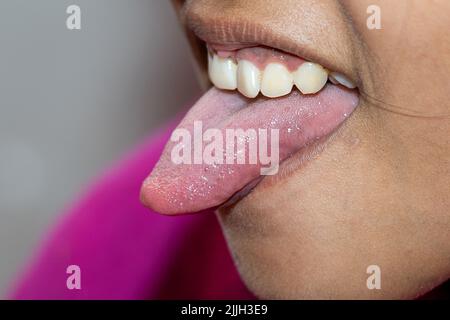 Nahaufnahme der Geschmacksknospe auf der Zunge der Frau Stockfoto