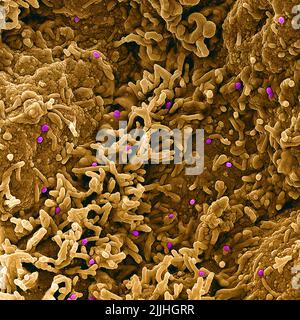 Fort Detrick, Usa. 26.. Juli 2022. Ein koloriertes Rasterelektronenmikrograph des Monkeypox-Virus (violett) auf der Oberfläche infizierter VERO E6-Zellen (tan), aufgenommen in der NIAID Integrated Research Facility, veröffentlicht am 26. Juli 2022 in Fort Detrick, Maryland. Kredit: NIAID/NIAID/Alamy Live Nachrichten Stockfoto