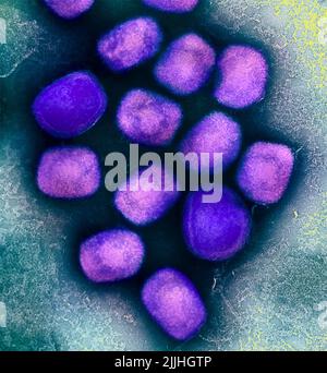 Fort Detrick, Usa. 26.. Juli 2022. Eine kolorierte Transmissionselektronenmikroskopie von Monkeypox-Viruspartikeln (violett), die aus Zellkulturen kultiviert und gereinigt wurden, aufgenommen in der NIAID Integrated Research Facility, die am 26. Juli 2022 in Fort Detrick, Maryland, veröffentlicht wurde. Kredit: NIAID/NIAID/Alamy Live Nachrichten Stockfoto