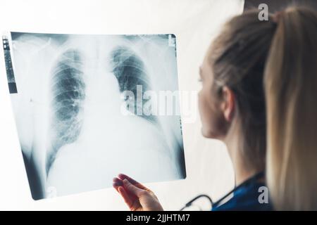 Beleuchtetes Lungenröntgenbild, das von einer jungen europäischen Pneumologin gehalten wird. Gesundheitskonzept. Hochwertige Fotos Stockfoto