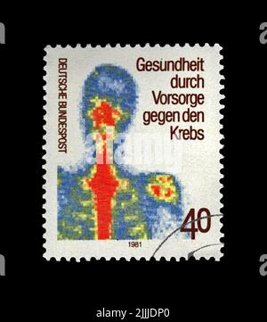 Früherkennung von Krebs (Untersuchung zur Prävention menschlicher Erkrankungen), um 1981. Abgestempelter Stempel gedruckt in Deutschland Stockfoto