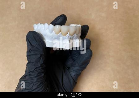 Eine Hand mit schwarzem Handschuh, der Zahnersatz auf grauem Hintergrund hält Stockfoto