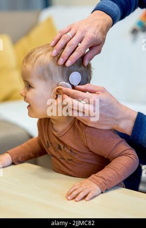 Eine Aufnahme eines tauben Kindes mit Cochlea-Implantaten Stockfoto