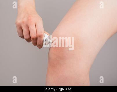 Frau, die schmerzlindernde Creme auf das Knie legt. Konzept für Beinverletzungen. Blutergüsse, Verstauchung, Arthritis Heilung. Gesundheitliche Probleme, Erkrankungen. Hochwertige Fotos Stockfoto